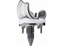 PROFIX knee: image from Smith and Nephew